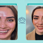 نمونه کار جراحی فک
