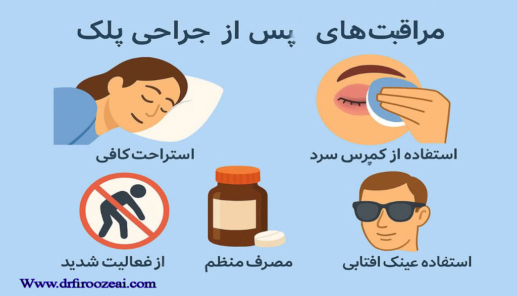 مراقبت های بعد از جراحی پلک