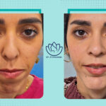 نمونه کار جراحی فک