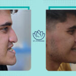 نمونه جراحی فک