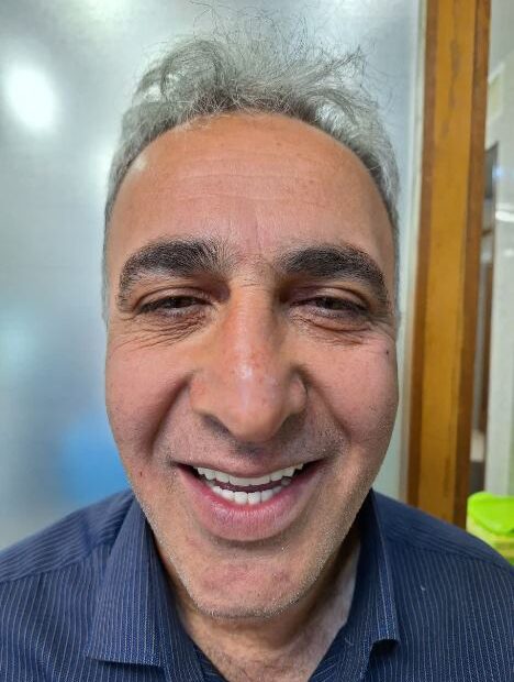 نمونه کار ایمپلنت دکتر فیروزه ای